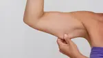 flabby arms on a lady
